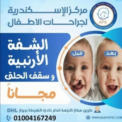 مركز الاسكندرية لجراحات الاطفال